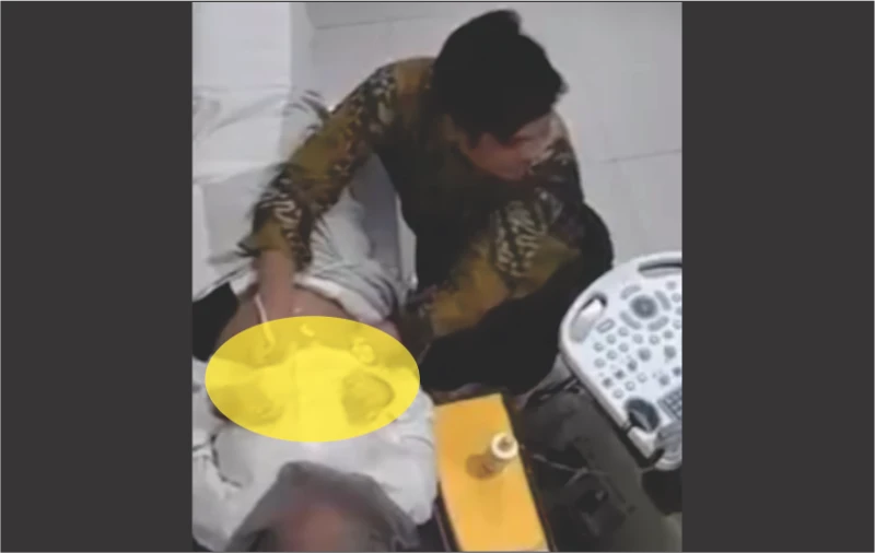 Korban Pelecehan Dokter Kandungan di Garut Dua Orang